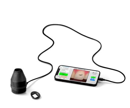 Smile Line OptiShade Digital Shade Matching