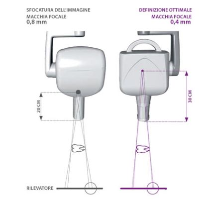 MyRay  RXDC Extend Wireless Cart