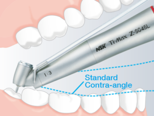 NSK Surgical Ti-Max Z-SG45